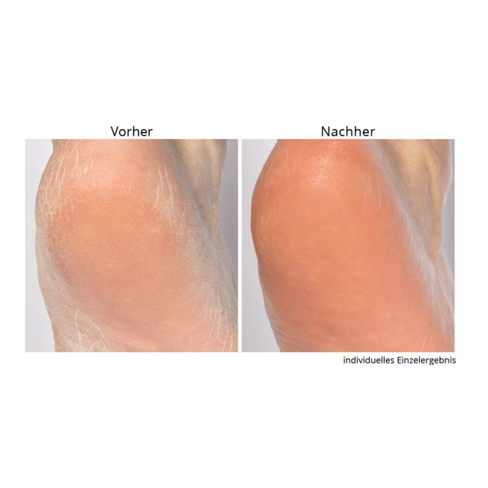 'Non-negotiable Foot Fetish' Foot Care Set - 118 ml, 75 g