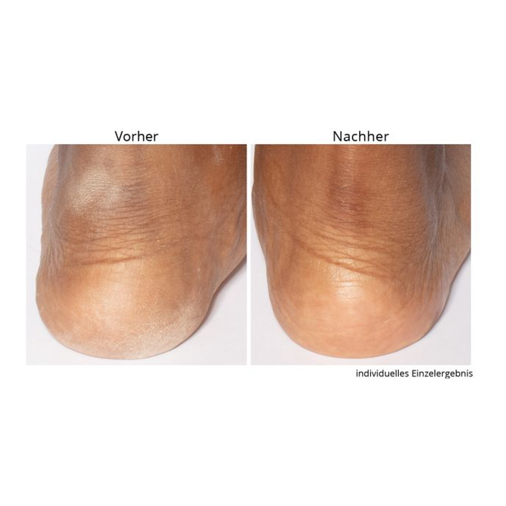 'Non-negotiable Foot Fetish' Foot Care Set - 118 ml, 75 g