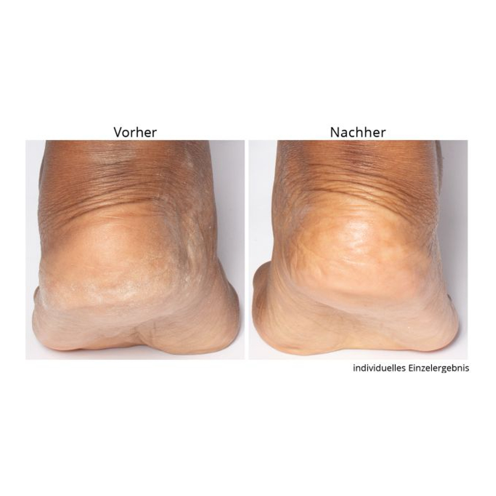 'Non-negotiable Foot Fetish' Foot Care Set - 118 ml, 75 g