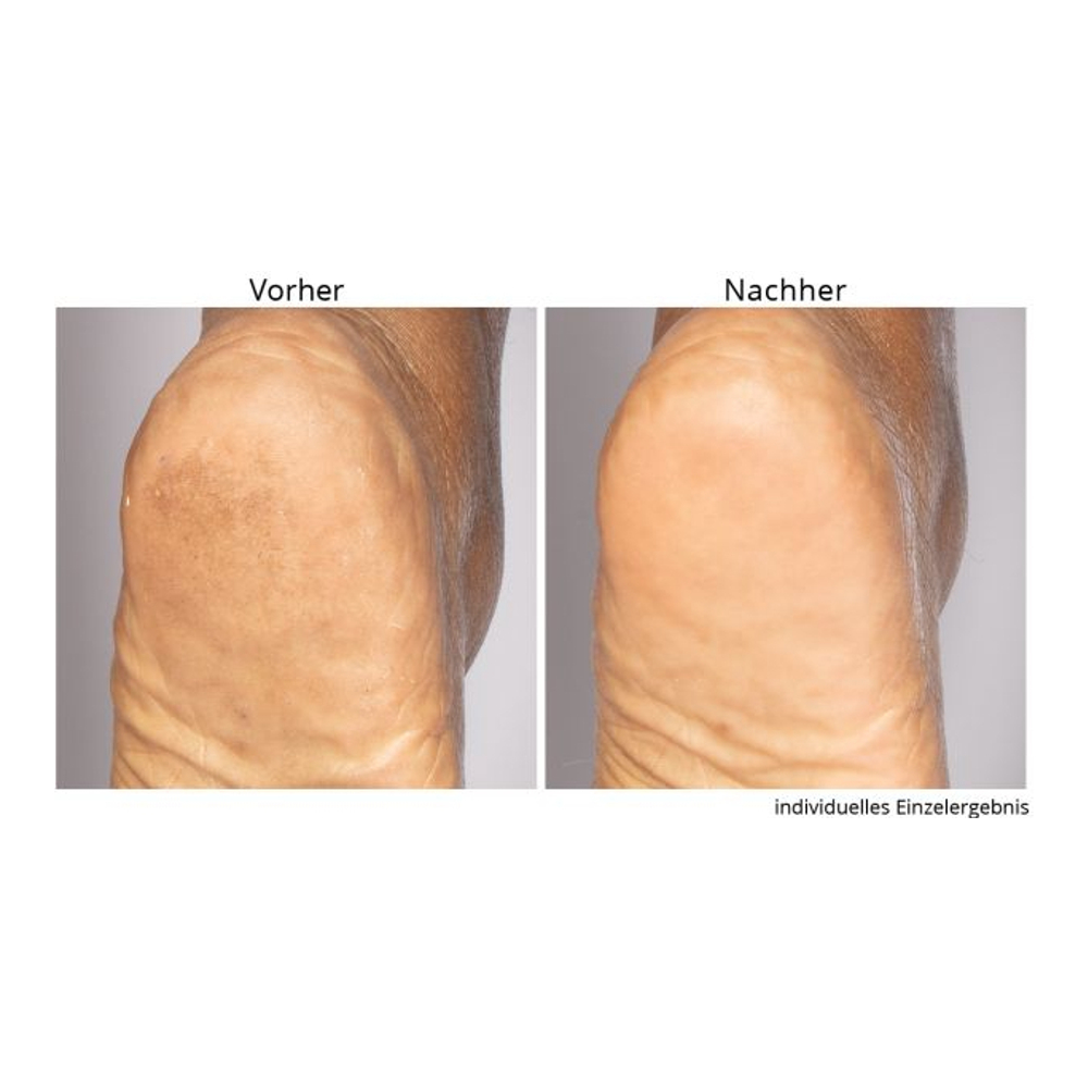 'Non-negotiable Foot Fetish' Foot Care Set - 118 ml, 75 g