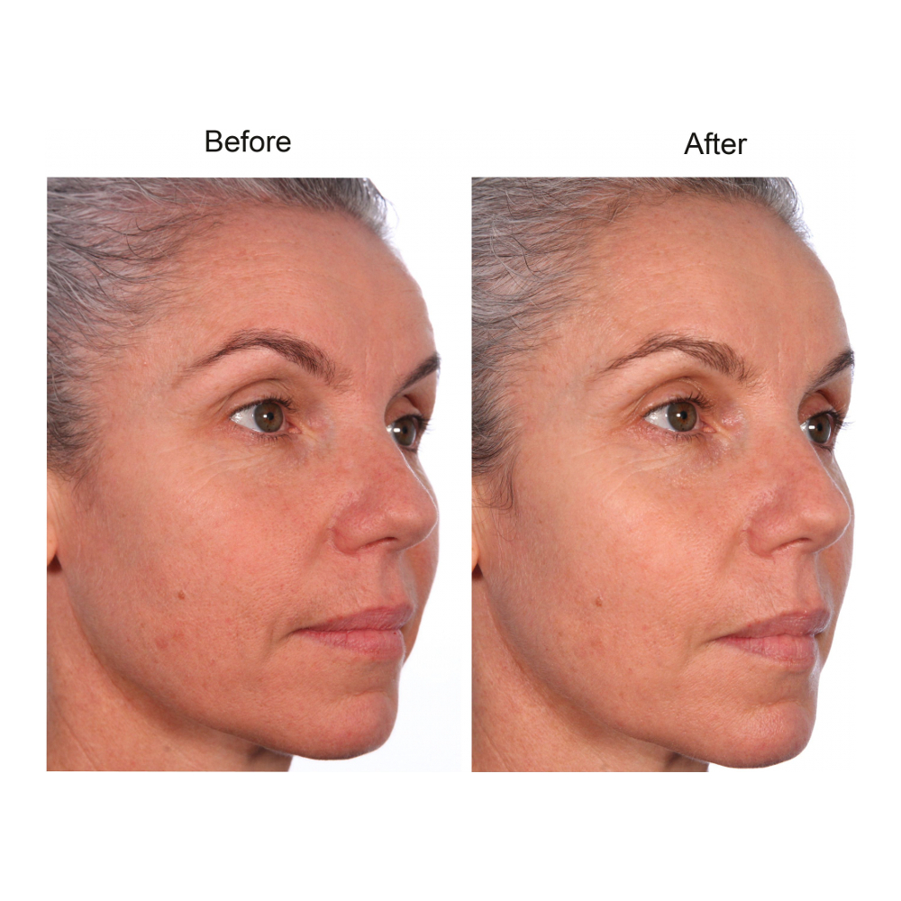 'PEP40' Face Care Set - 50 ml