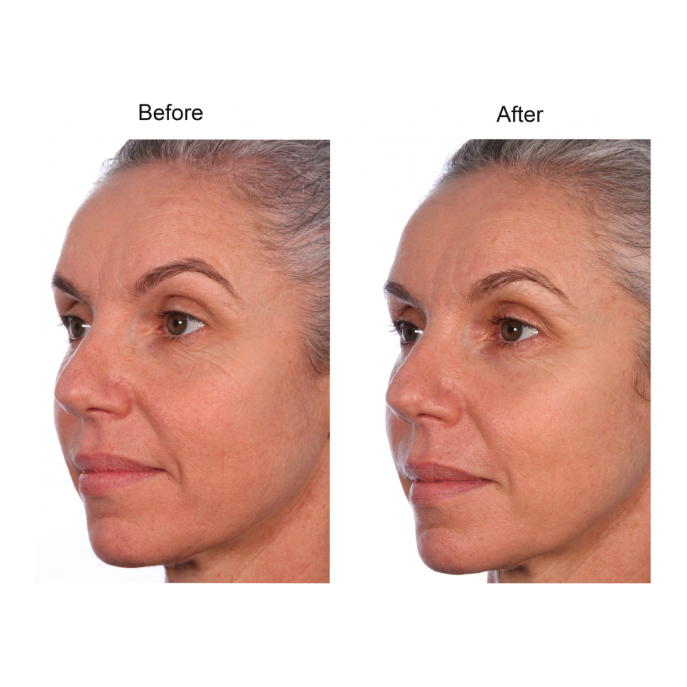 'PEP40' Face Care Set - 50 ml