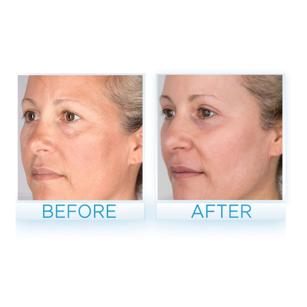 'PEP40' Face Care Set - 50 ml