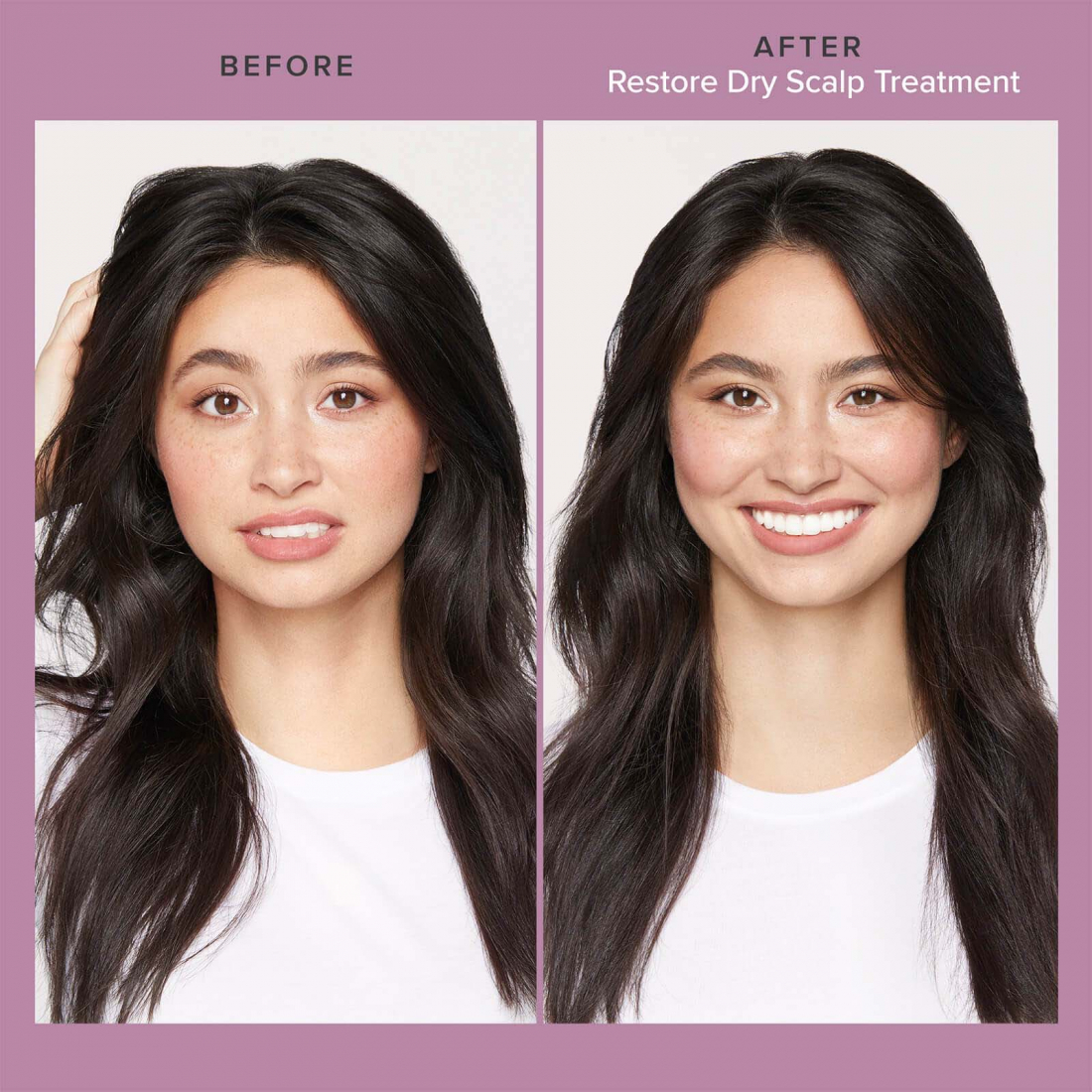 'Restore' Scalp Treatment - 100 ml