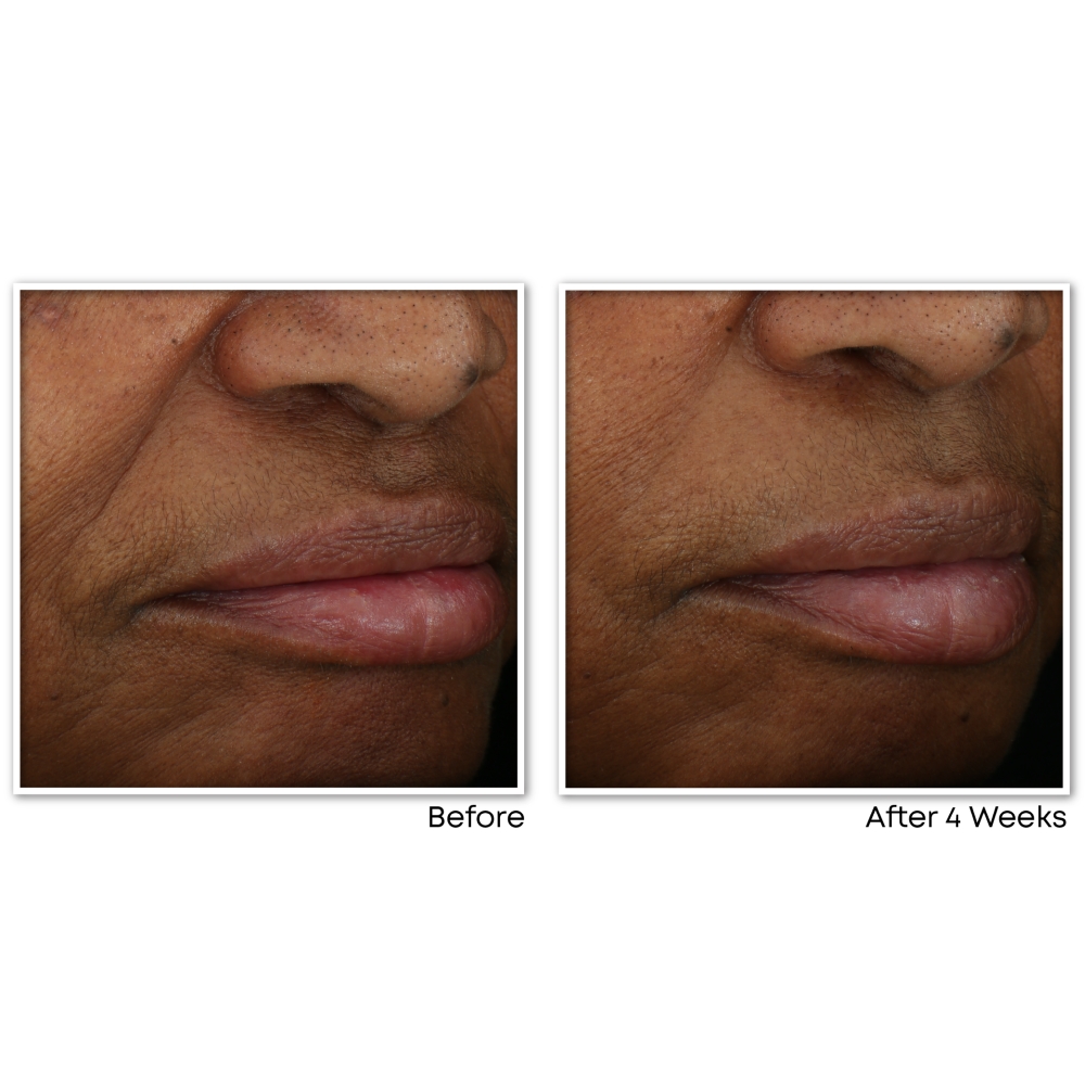 'Renouveau + Eclat' Gel Cream - 50 ml