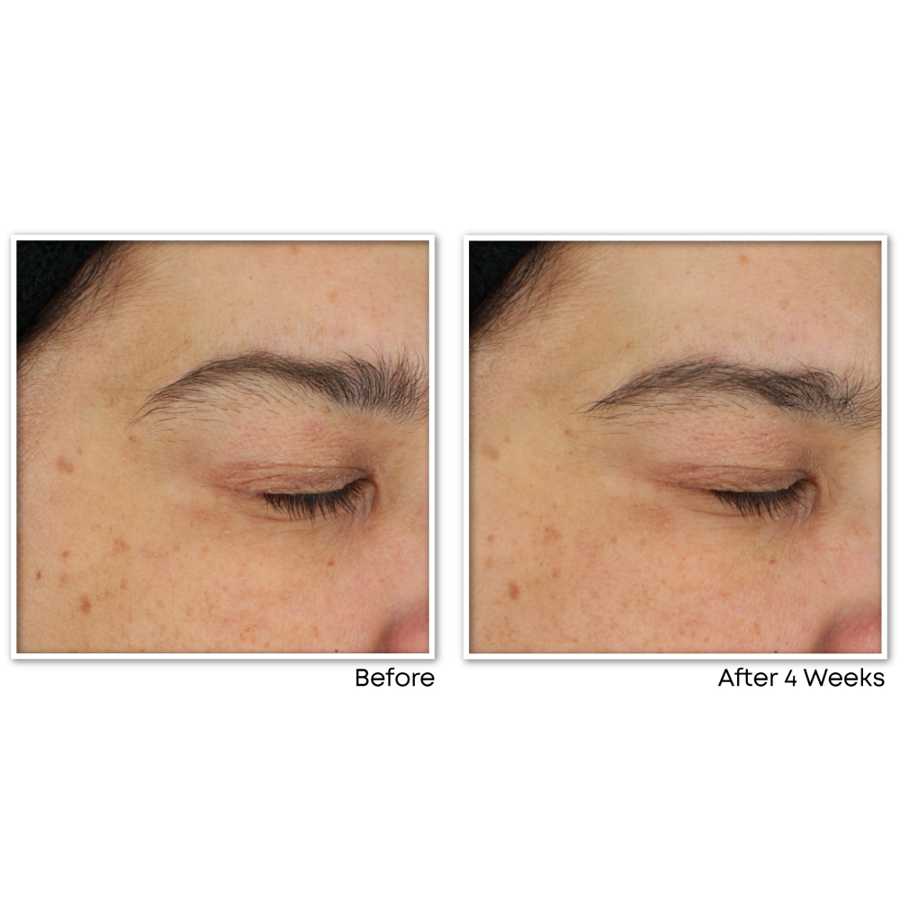 'Renouveau + Eclat' Gel Cream - 50 ml