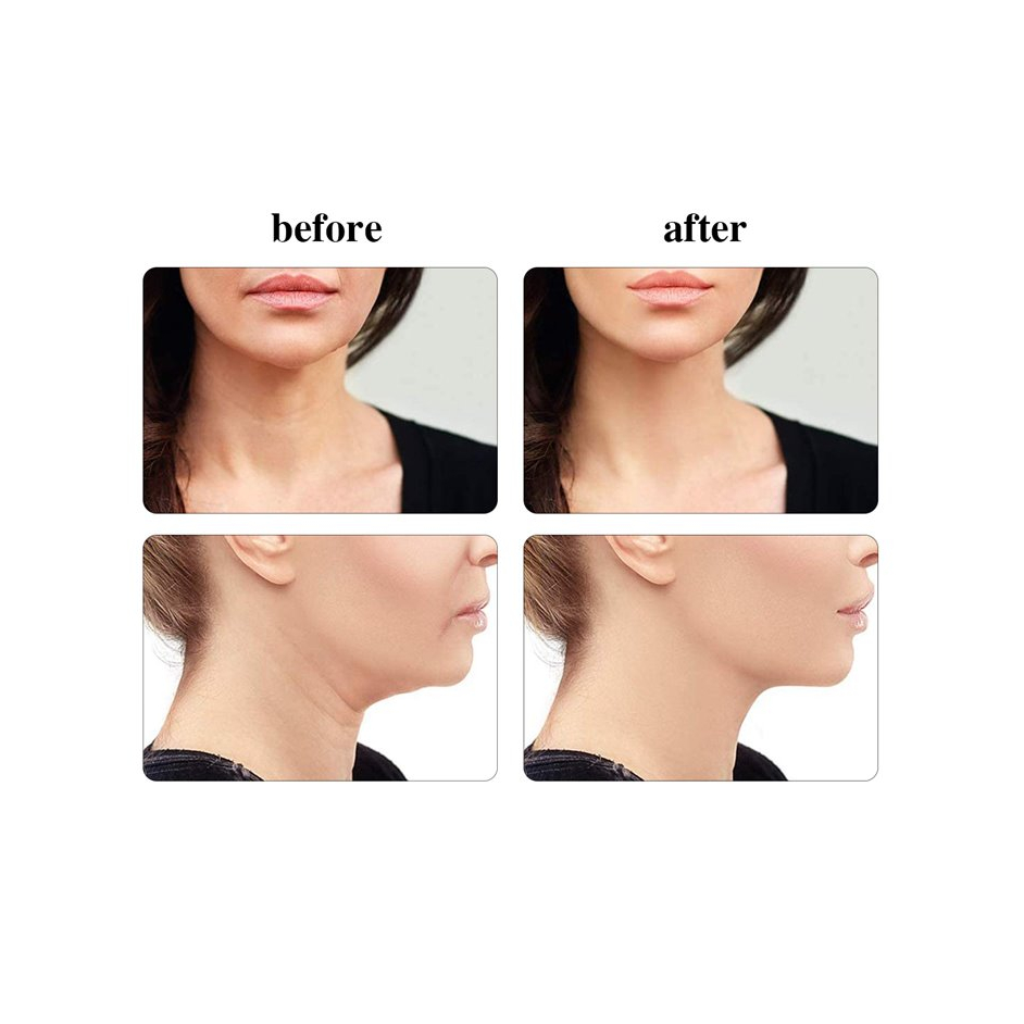 Dispositif anti-âge 'Neck & Face'