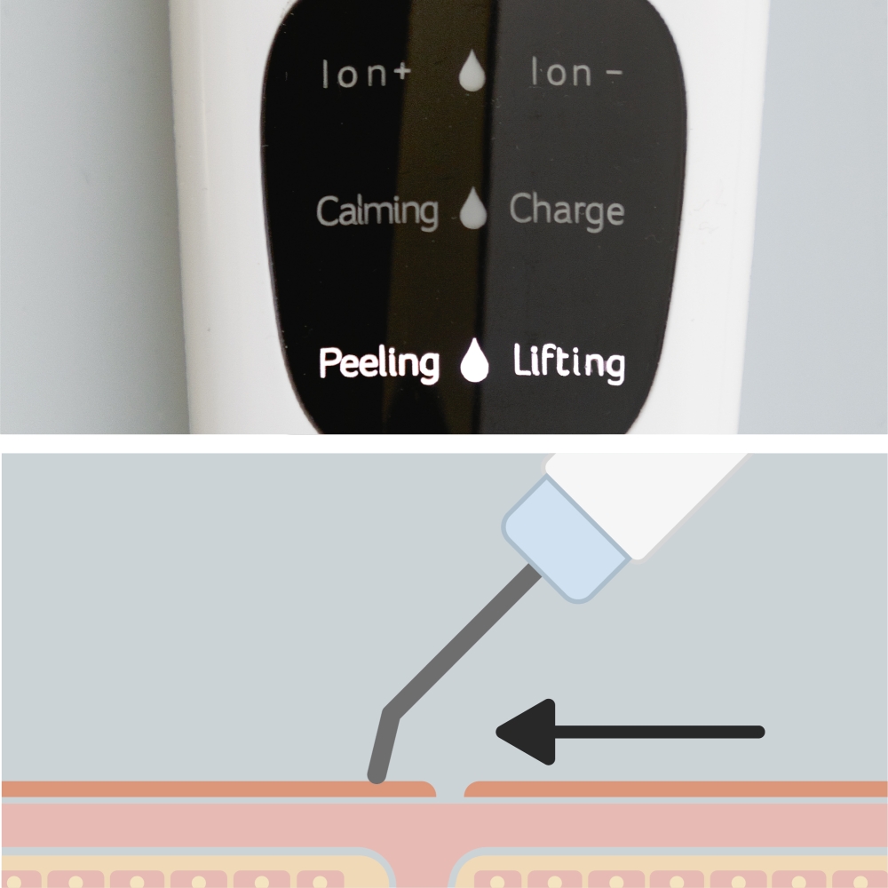 '5-in-1 Ultrasonic Feanser' Face Cleanser
