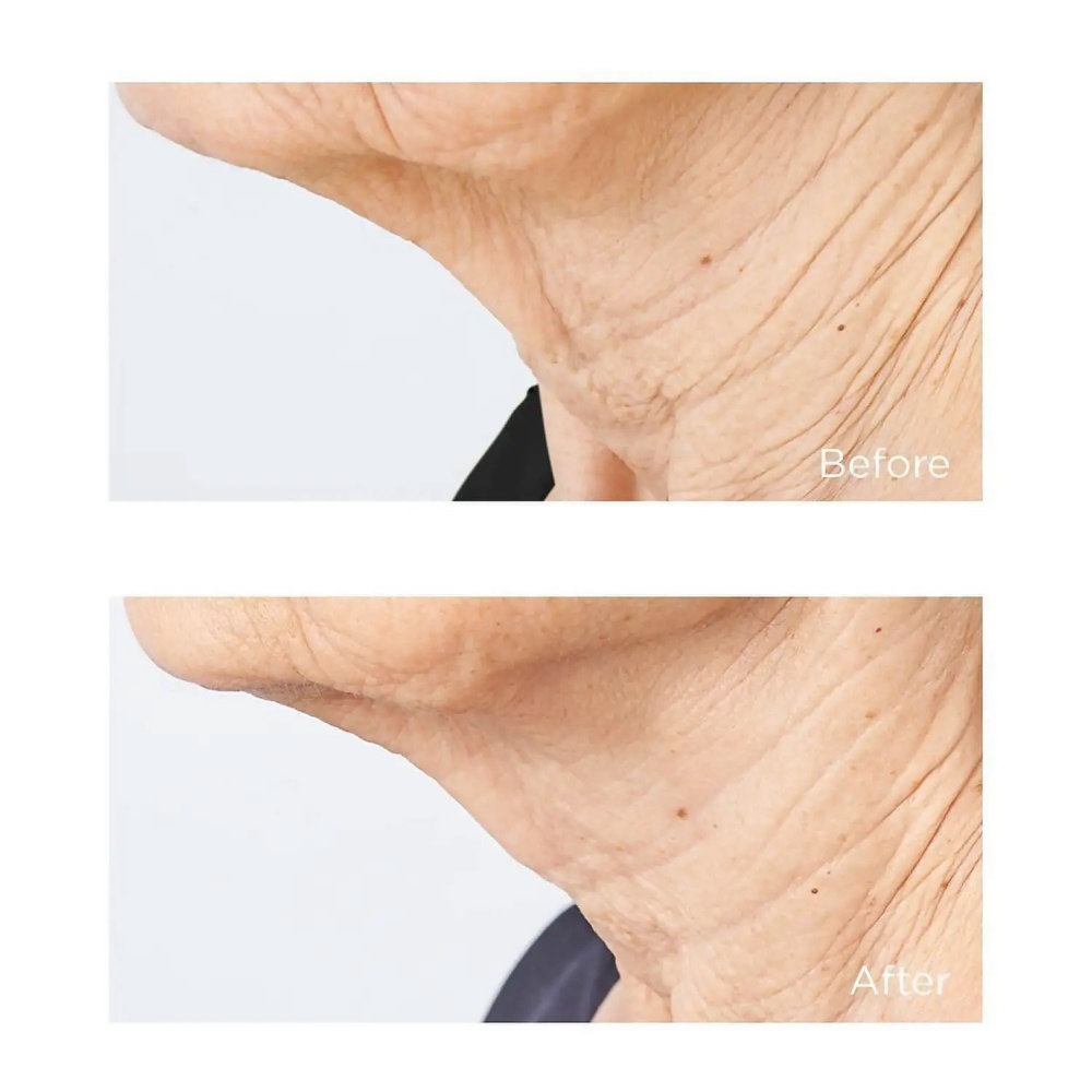 Crème pour le cou 'Cold Plasma Plus+ Sub-D' - 60 ml