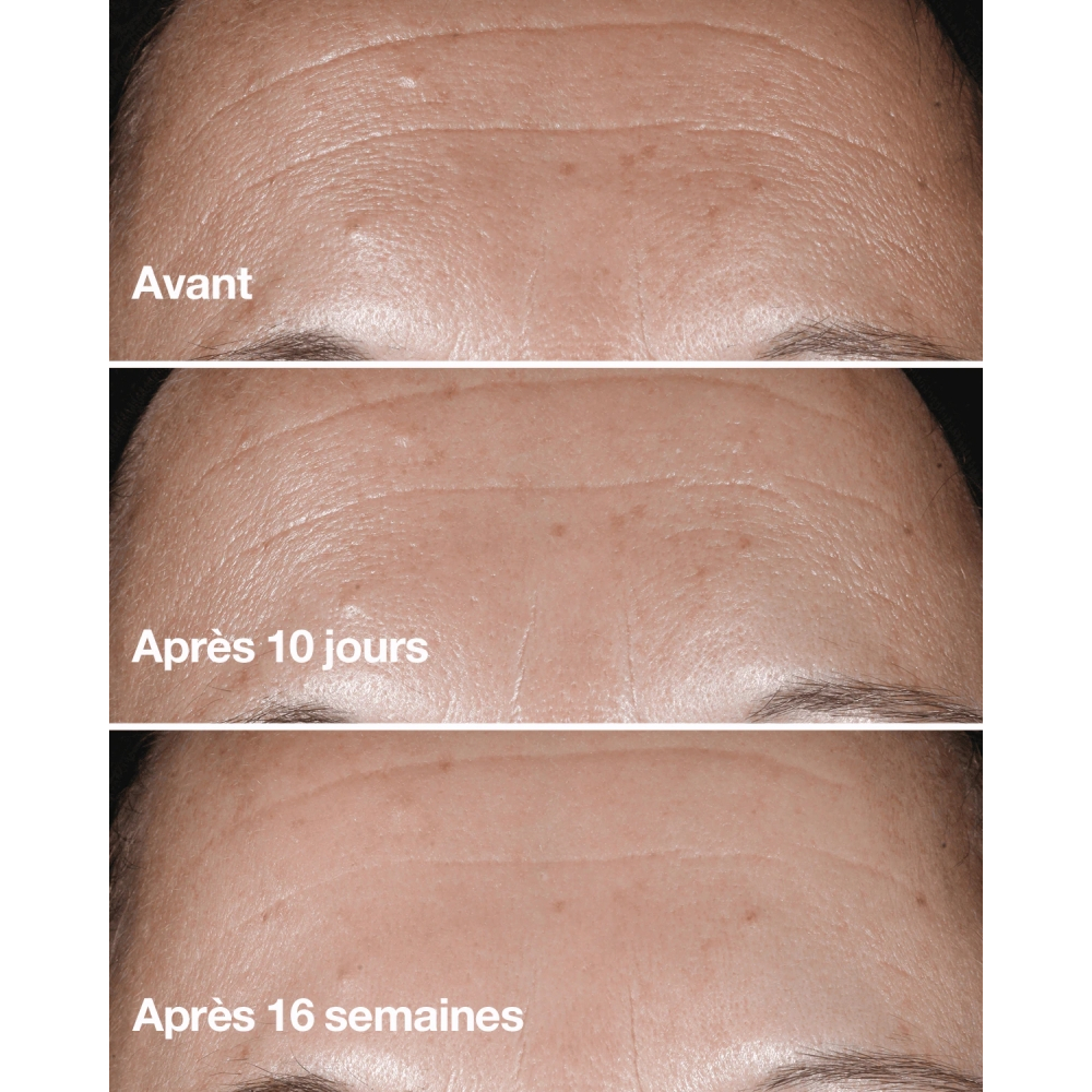 'Smart Clinical Repair™' Anti-Falten-Serum - 30 ml