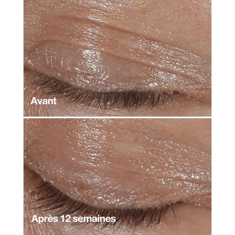 'Smart Clinical Repair™' Eye Cream - 15 ml